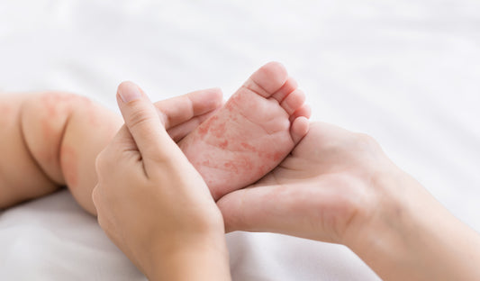 Allergy Considerations When Starting Solids